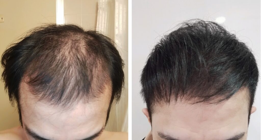 散髪後のビフォーアフター