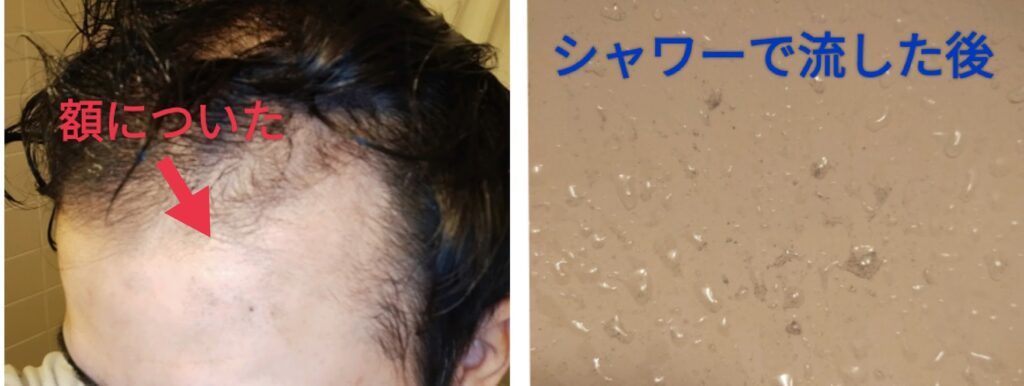 増毛パウダー使用し、シャワーで流した様子の写真