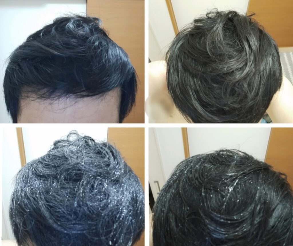 ミリオンヘアー使用後、テニス3時間の汗と霧吹きによる水濡れ耐性を検証した頭部の比較画像